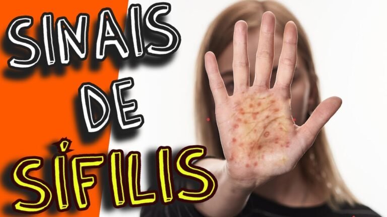 Casos de sífilis no país somam 783 mil em uma década, revela pesquisa