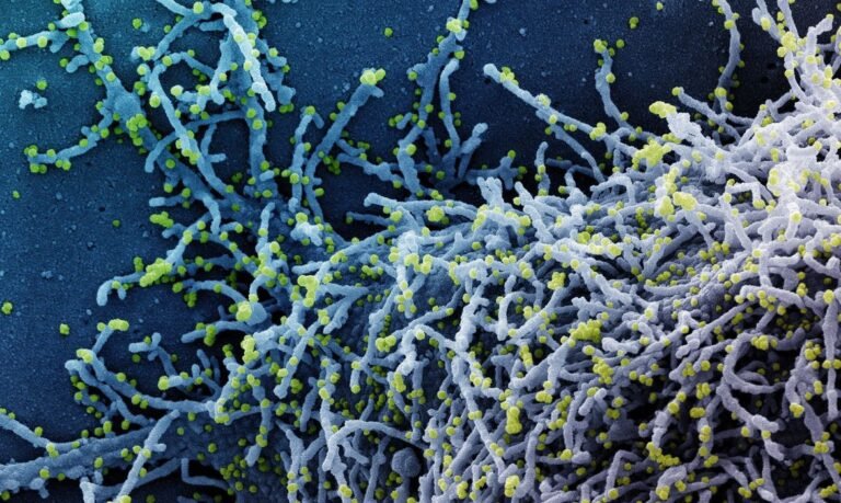Biomarcador consegue prever gravidade da covid-19, segundo estudo