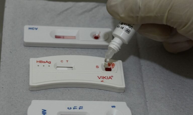 Unidades de Saúde oferecem teste rápidos de HIV no ‘Dezembro Vermelho’