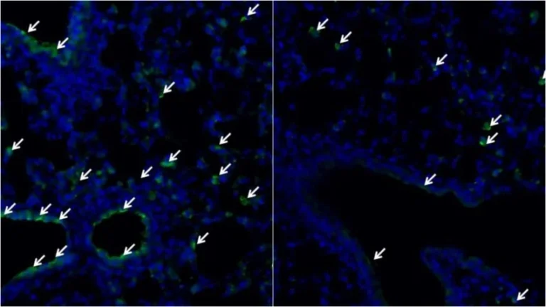 Molécula produzida no intestino pode ter efeito protetor contra gripe, indica estudo